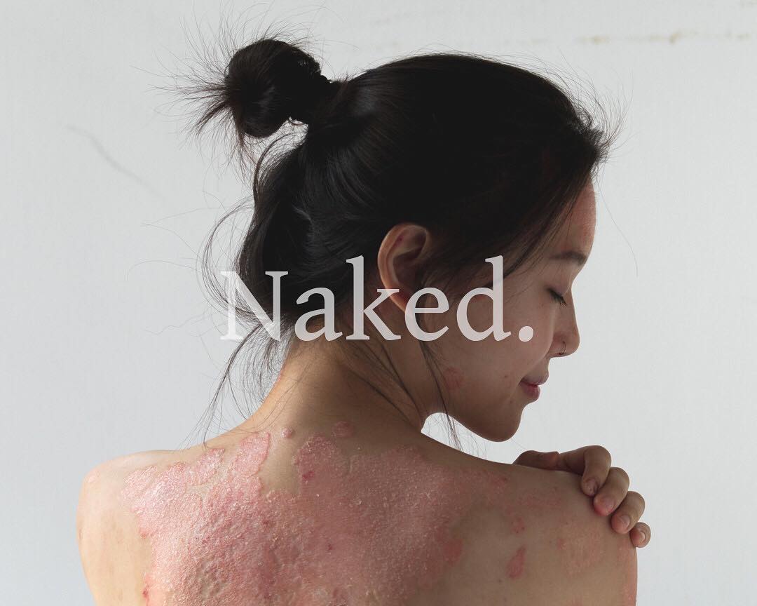 Project Naked saved her life.